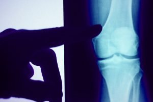 Xray services at our walk in clinic