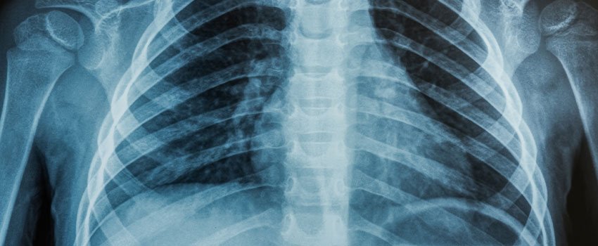 Does AFC Offer X-Ray Services?