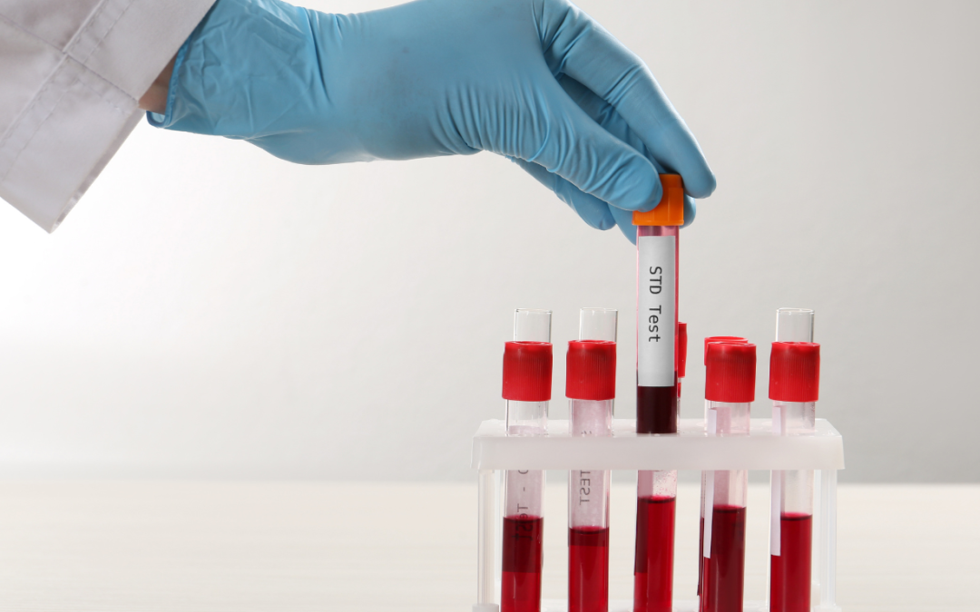 How Long Does It Take To Cure Syphilis?